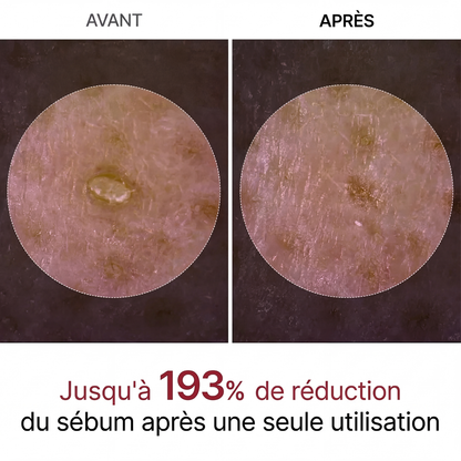 Peel Shot Exfoliant au Riz Blanc & Noir : L'Effaceur d'Impuretés