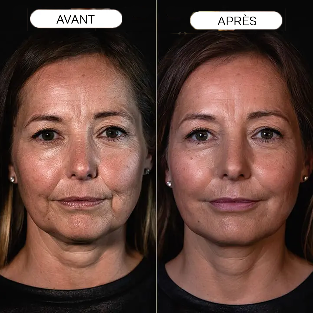Baume Réparateur de Rides au Calcium :  Le Soin Fermeté Haute Performance