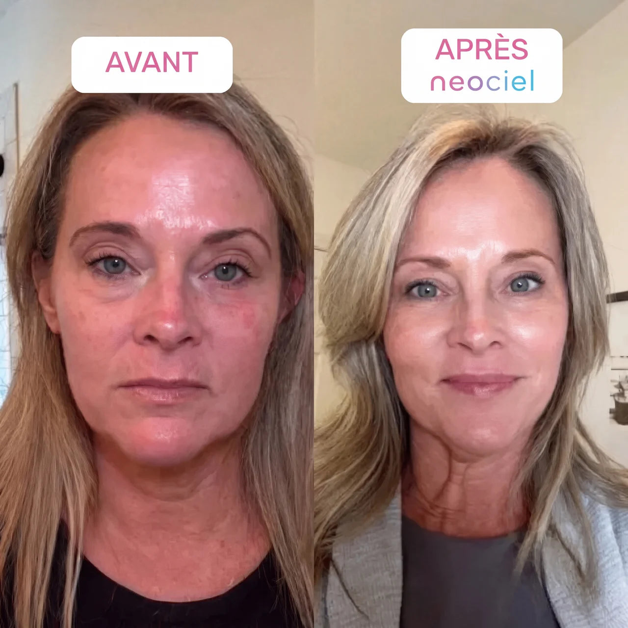 Retinal Shot Booster Anti-Âge