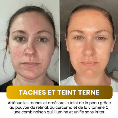 Masque Éclat Intense au Curcuma + Collagène