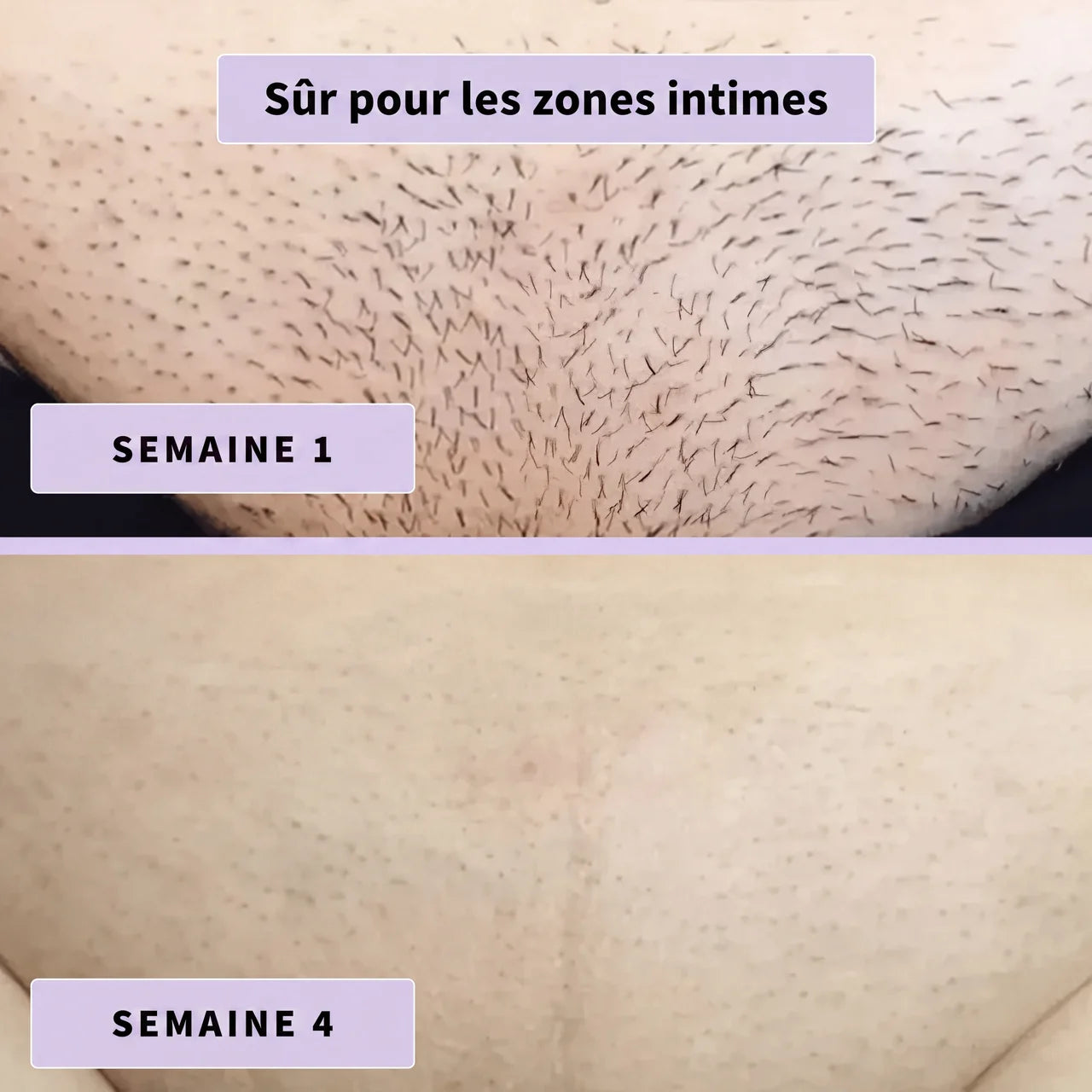 Sérum Naturel Anti-Poils Neociel™