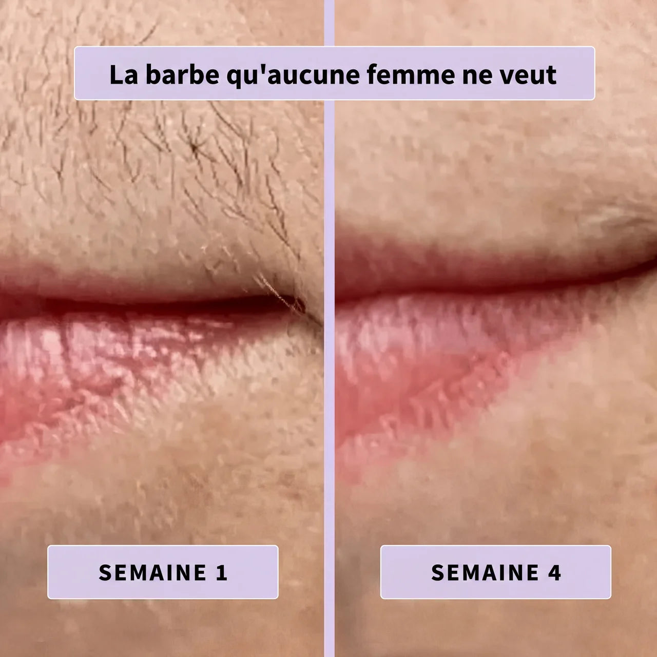 Sérum Naturel Anti-Poils Neociel™