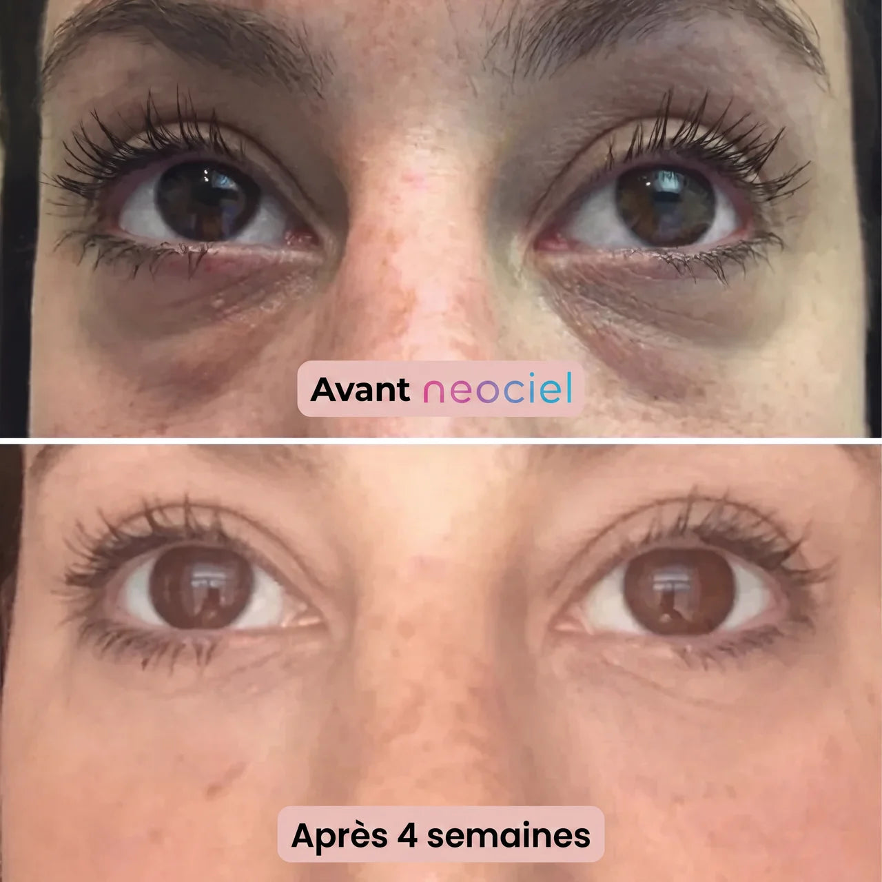 Patchs Anti-Cernes à Micro-Infusion