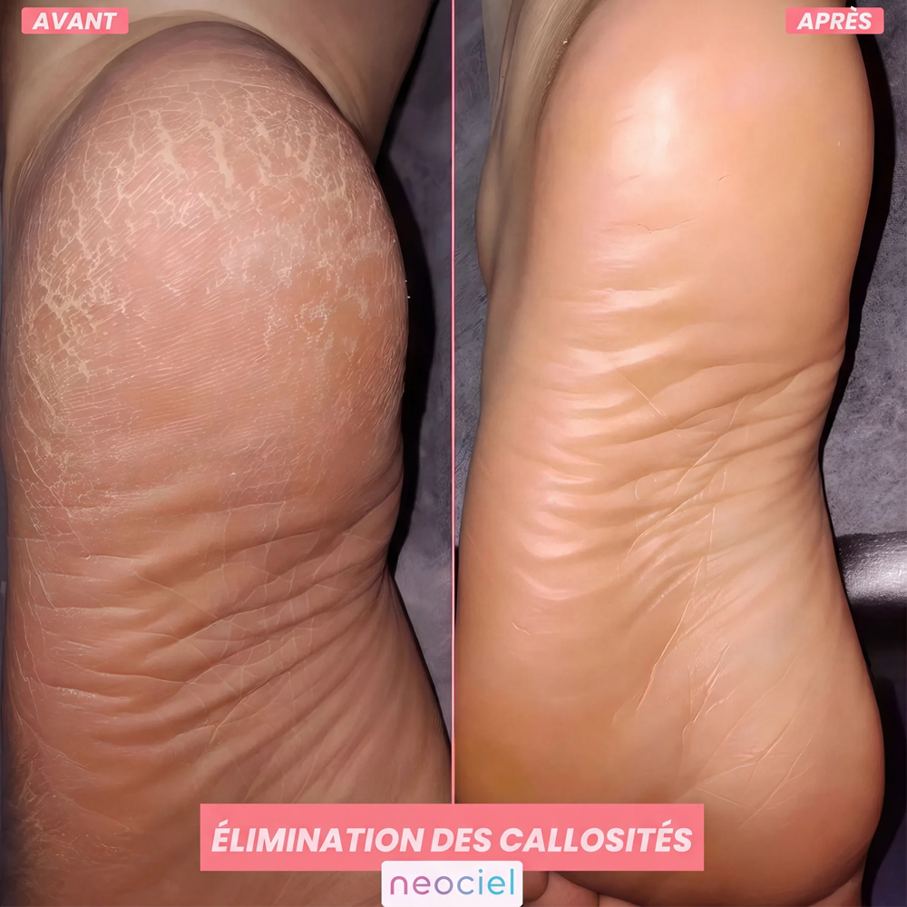 FootGlow™ - L'ORIGINAL