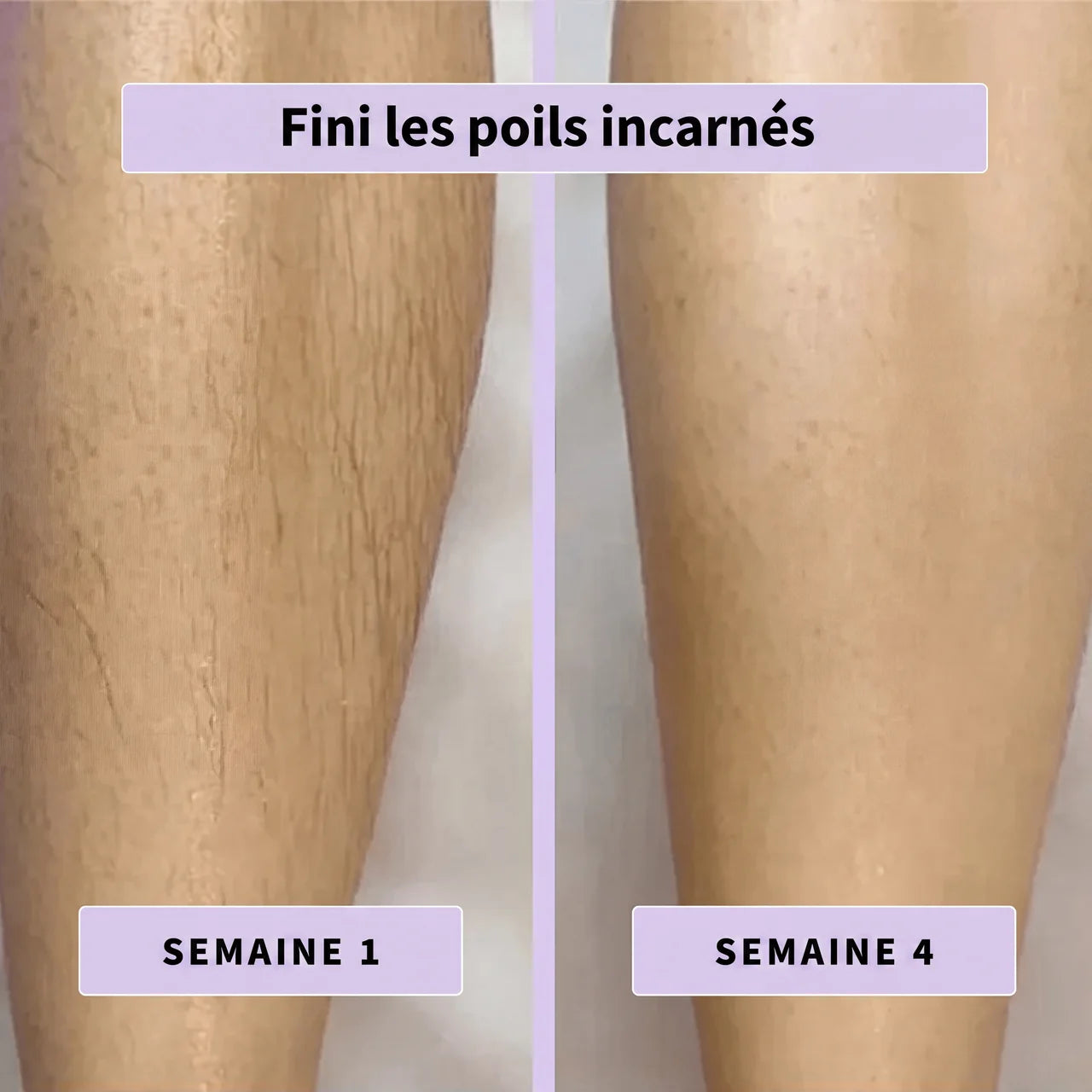 Sérum Naturel Anti-Poils Neociel™