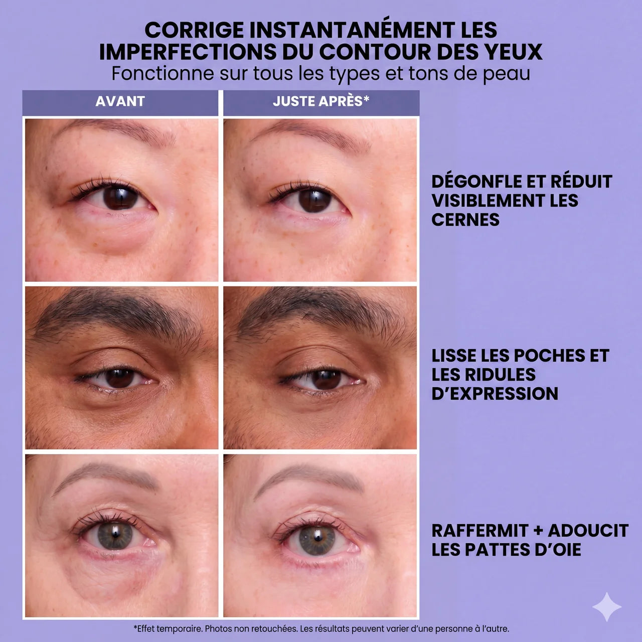 InstantLift+ : Gel liftant rajeunissant pour les yeux