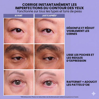 InstantLift+ : Gel liftant rajeunissant pour les yeux
