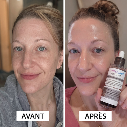 Peel Shot Exfoliant au Riz Blanc & Noir : L'Effaceur d'Impuretés
