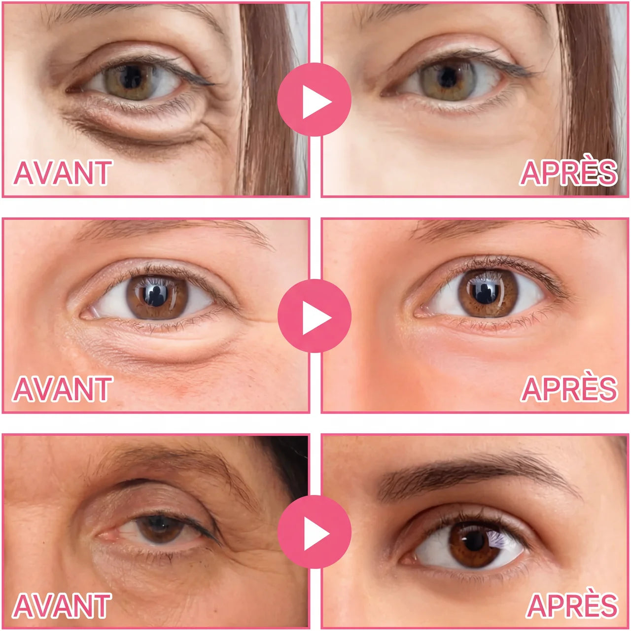 Patchs Anti-Cernes à Micro-Infusion