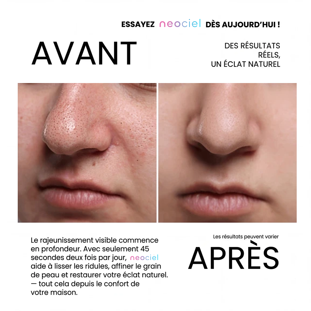 Peel Shot Exfoliant au Riz Blanc & Noir : L'Effaceur d'Impuretés