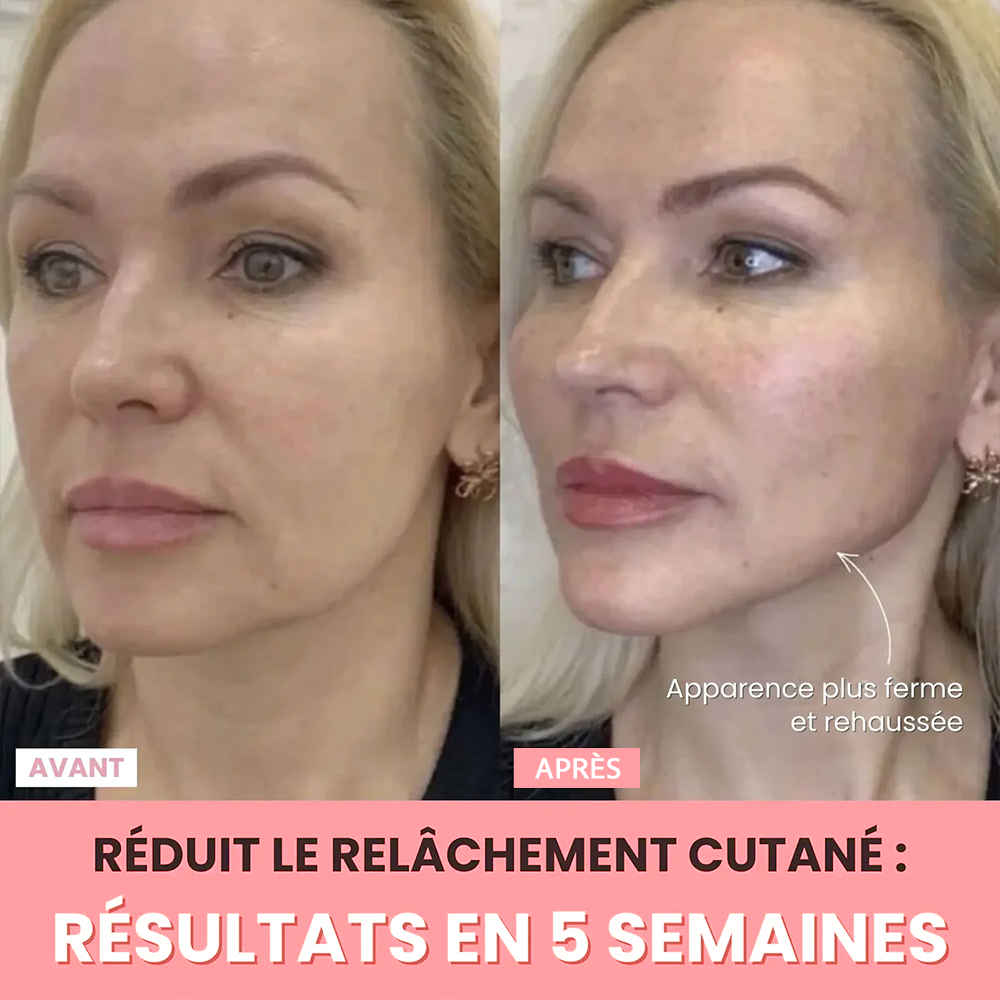 Sculpteur facial V-Shape LED 7-en-1