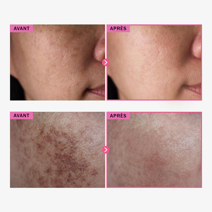 Neociel™ Crème réparatrice Arbutine 7% + Acide Tranexamique 4%