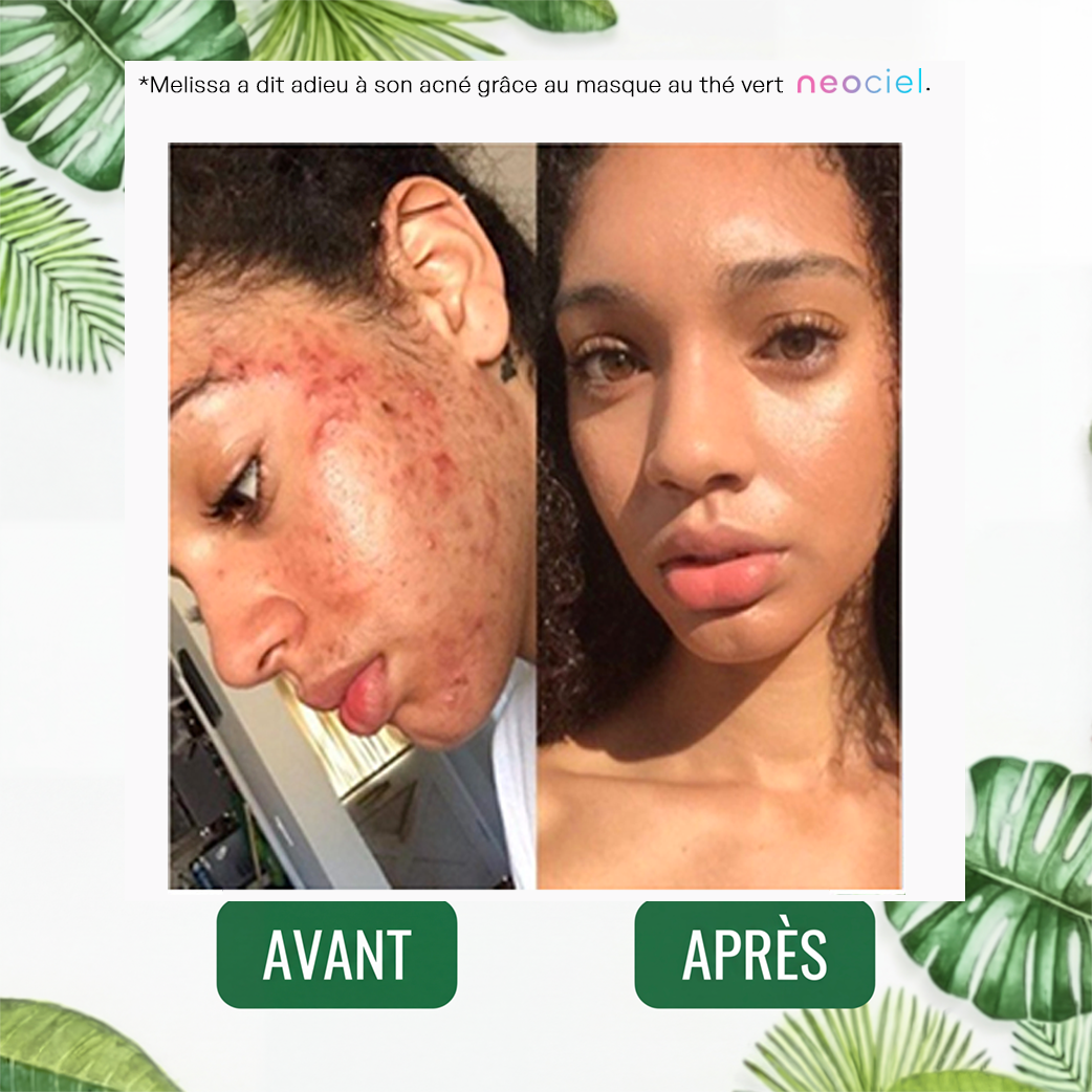 Stick Détox "Peau Nette" – Masque Solide au Thé Vert