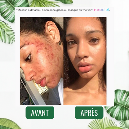Stick Détox "Peau Nette" – Masque Solide au Thé Vert