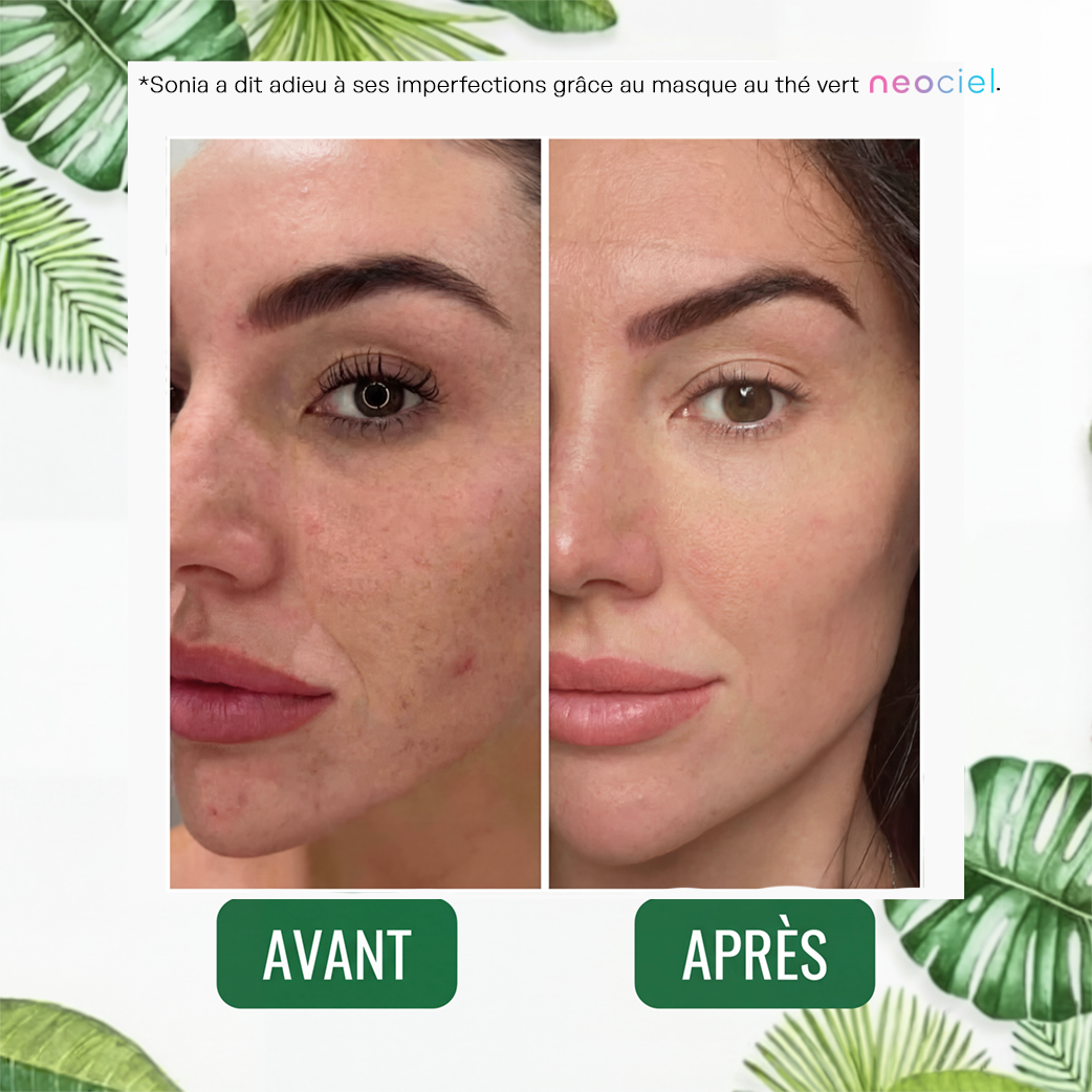 Stick Détox "Peau Nette" – Masque Solide au Thé Vert