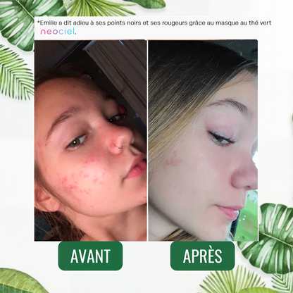 Stick Détox "Peau Nette" – Masque Solide au Thé Vert