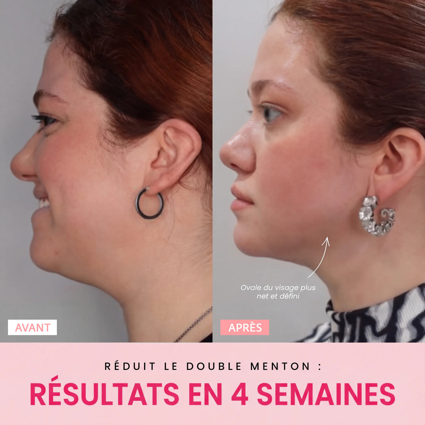 Sculpteur facial V-Shape LED 7-en-1