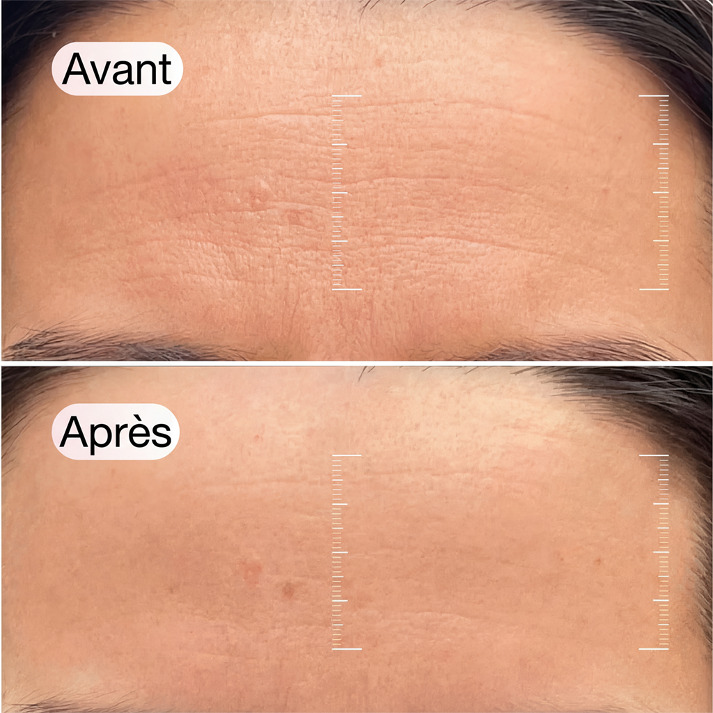 Masque Traitement Régénérant au Collagène + Niacinamide