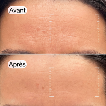 Masque Traitement Régénérant au Collagène + Niacinamide