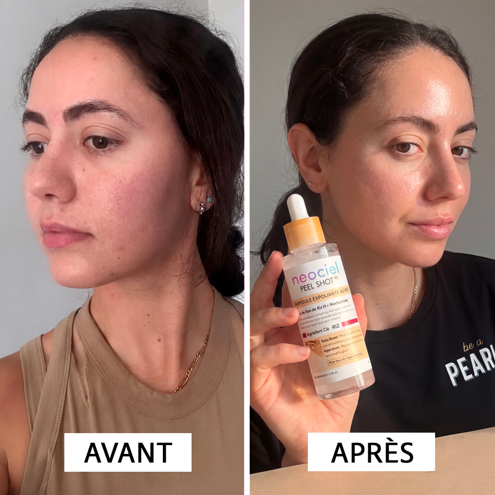 Peel Shot Exfoliant au Riz Blanc & Noir : L'Effaceur d'Impuretés