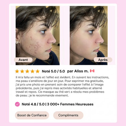 Stick Détox "Peau Nette" – Masque Solide au Thé Vert