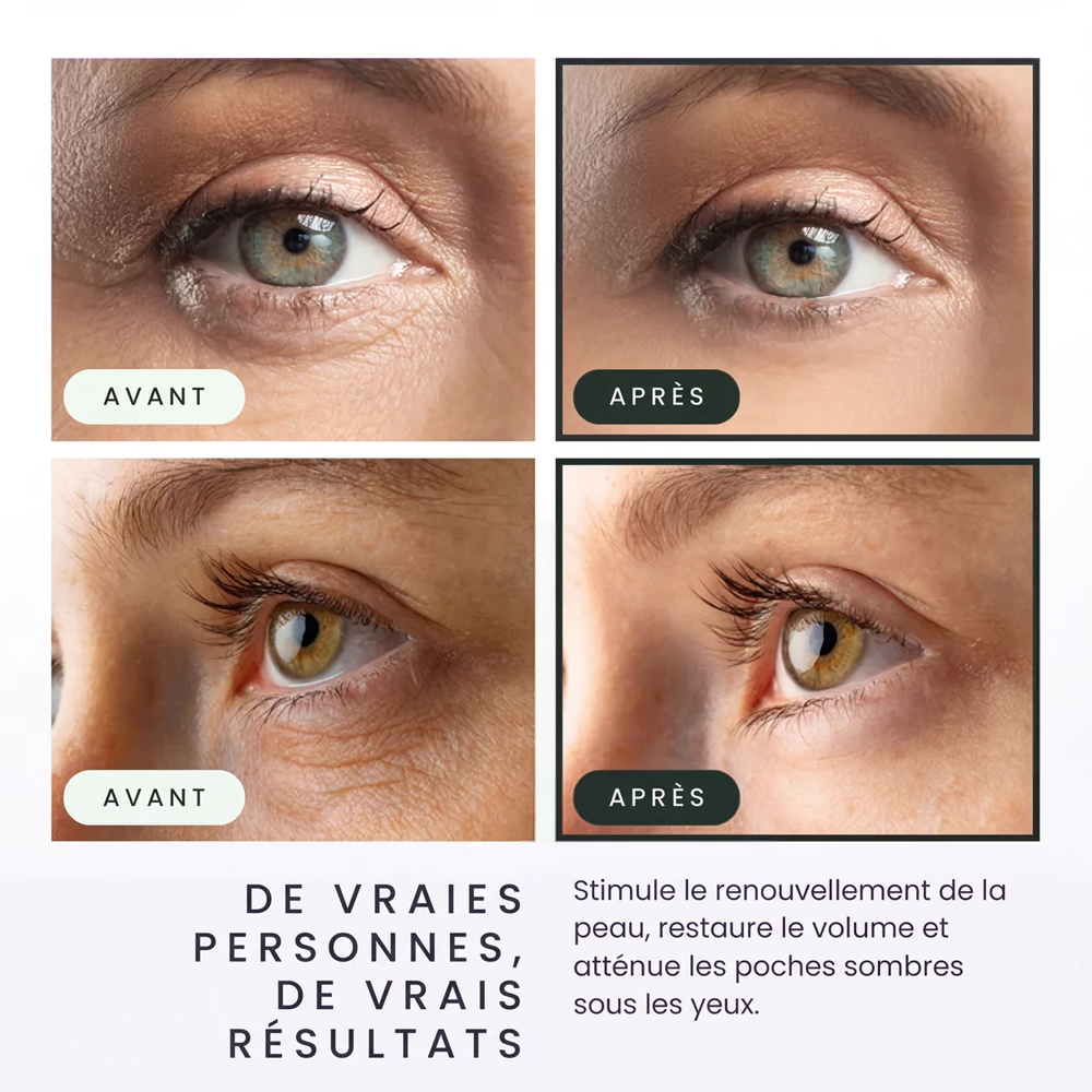 Baume Réparateur de Rides au Calcium :  Le Soin Fermeté Haute Performance