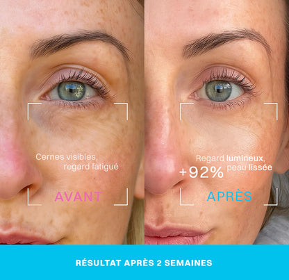 Neociel™ Soin contour des yeux 2 en 1 : crème + technologie LED rouge