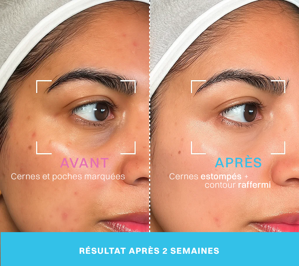 Neociel™ Soin contour des yeux 2 en 1 : crème + technologie LED rouge