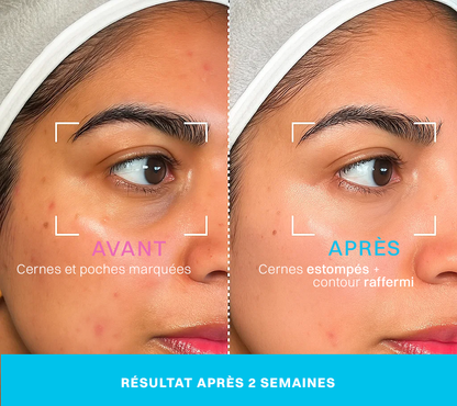 Neociel™ Soin contour des yeux 2 en 1 : crème + technologie LED rouge