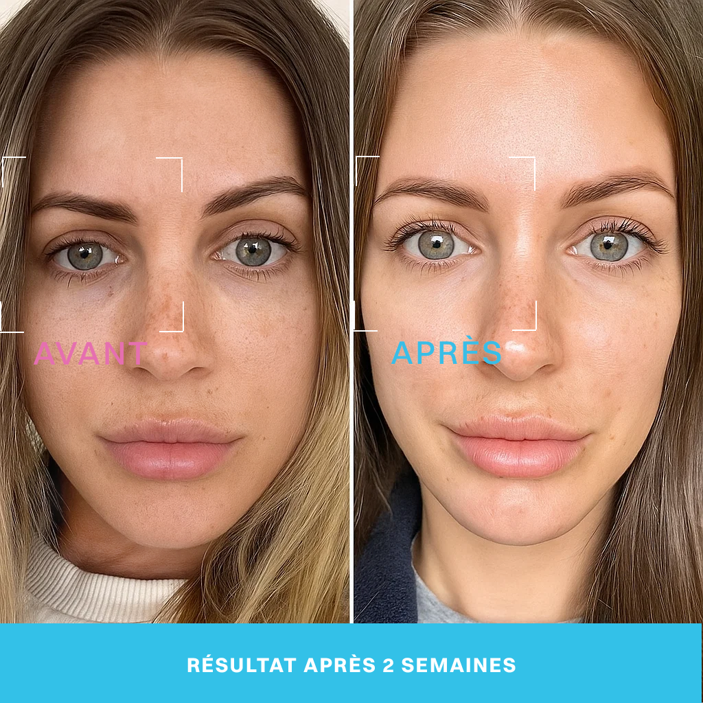 Neociel™ Soin contour des yeux 2 en 1 : crème + technologie LED rouge