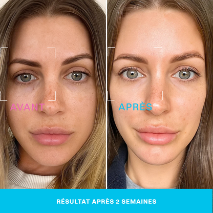 Neociel™ Soin contour des yeux 2 en 1 : crème + technologie LED rouge