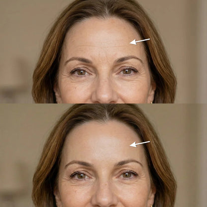 Lisseur de Rides Instantané — Des rides lissées en quelques secondes